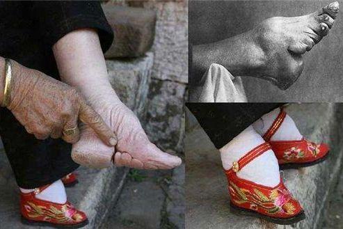 女人裹脚是从什么时候开始的优质 废除裹脚是哪一年